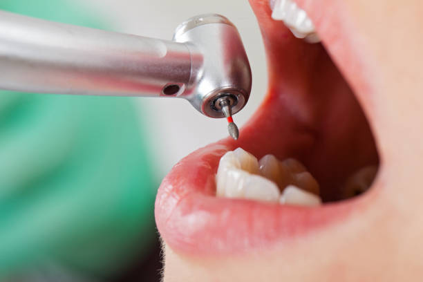 Best Emergency Dentist for Knocked-Out Tooth in Guilford Center, CT
